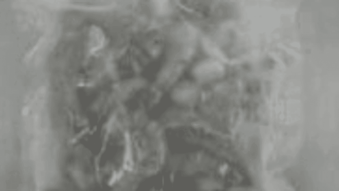 Imported Radioactive Shrimp Poisoning US Consumers Exposed