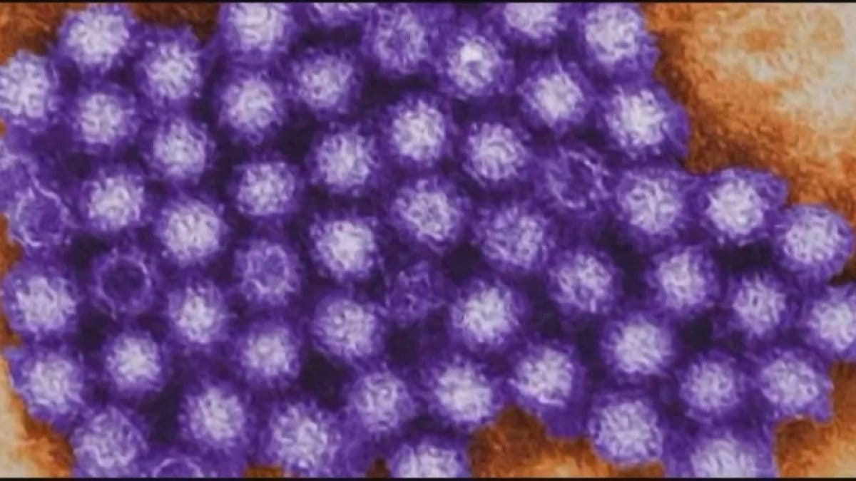 Stomach Bug Cover-Up: Officials Downplay New Norovirus Strain